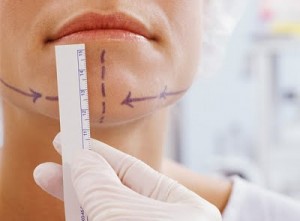 chin agumentation surgery