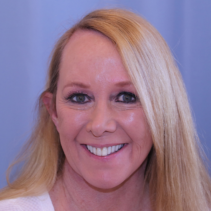 Facelift Before and After | Dr. Leslie Stevens