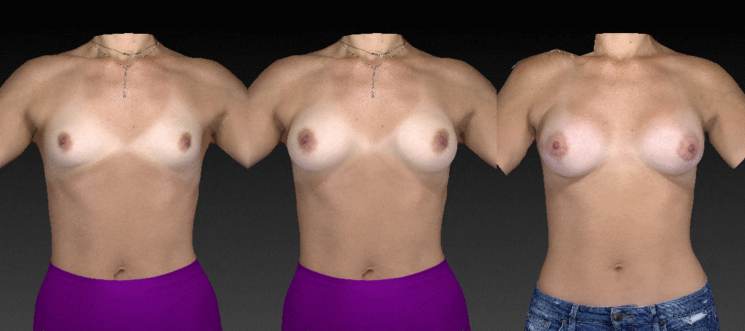Vectra 3D Results