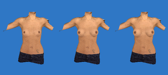 Vectra 3D Results`