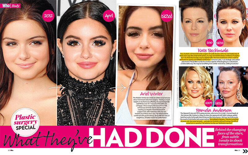 Who Body Article