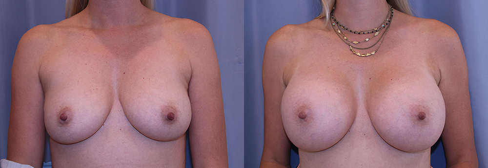 Actual Patient Results