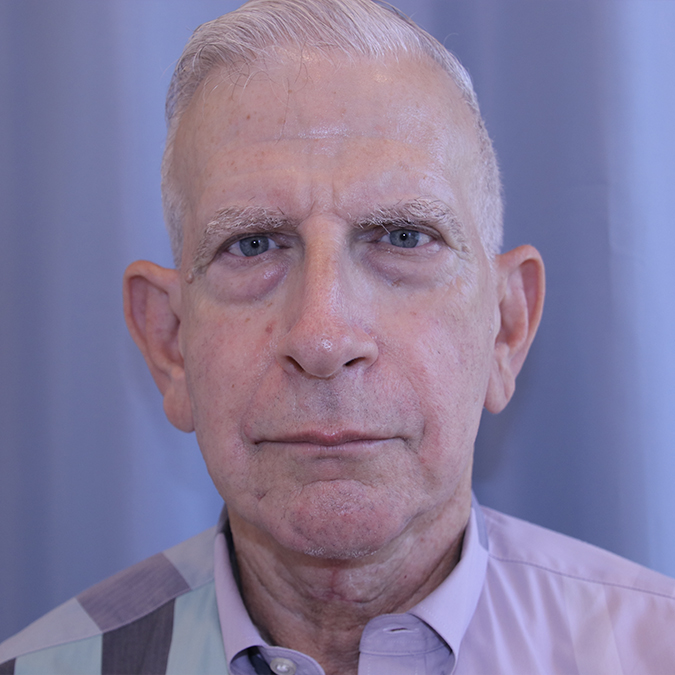 Neck-Lift-Case--04 | After Neck Lift