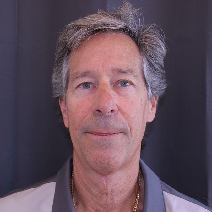 Neck-Lift-for-Men-Case--02 | After Neck Lift for Men